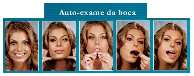 Auto exame – câncer bucal