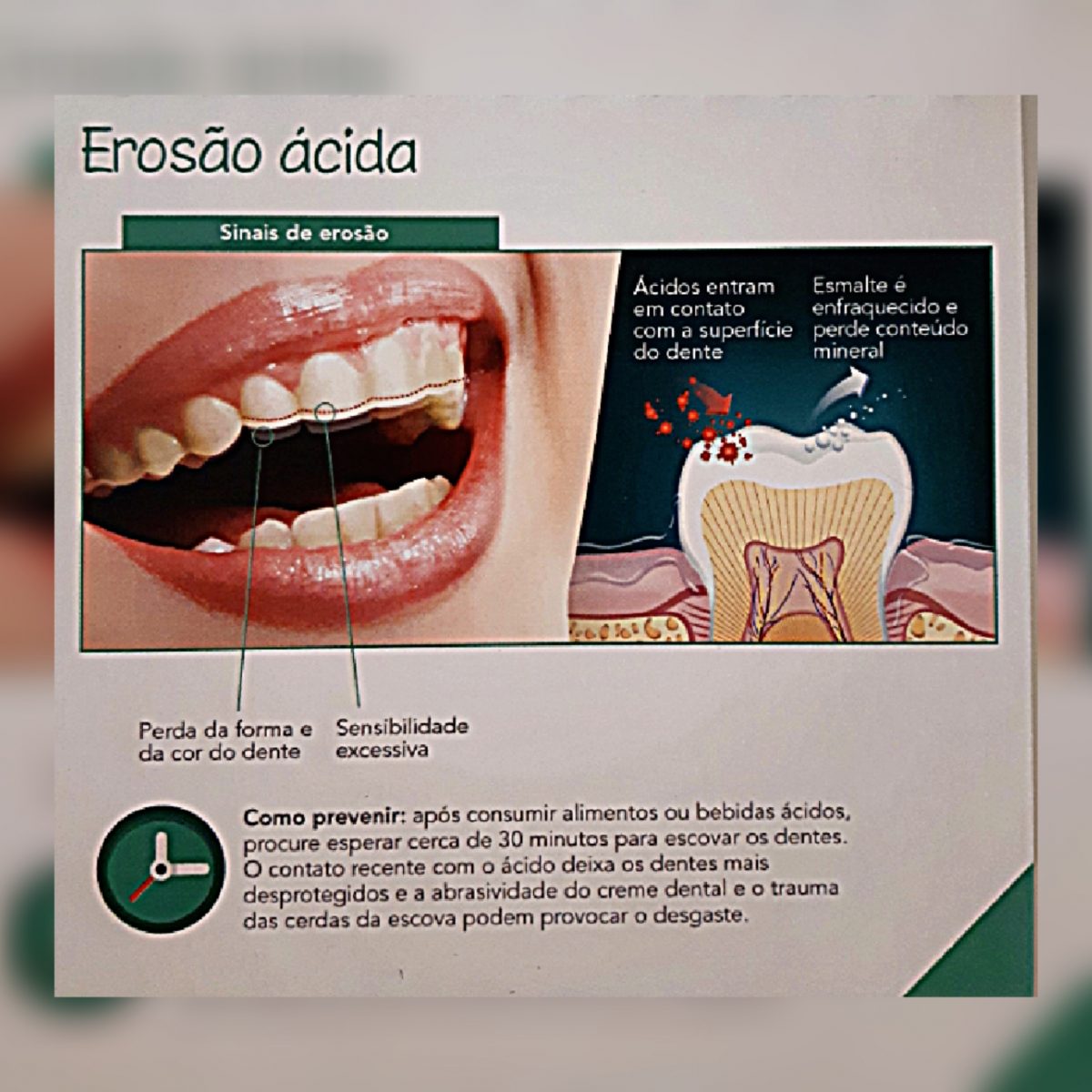 Erosão ácida